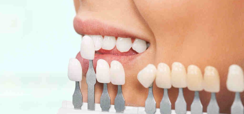 Stomatologia estetyczna -gabinet stomatologiczny klinika pięknego uśmiechu