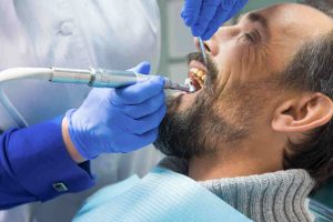 Chirurgia stomatologiczna usuwanie ósemek ekstrakcja zęba