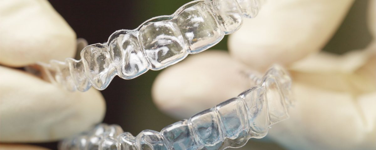 invisalign - aparat ortodontyczny - invisalign niewidoczny aparat